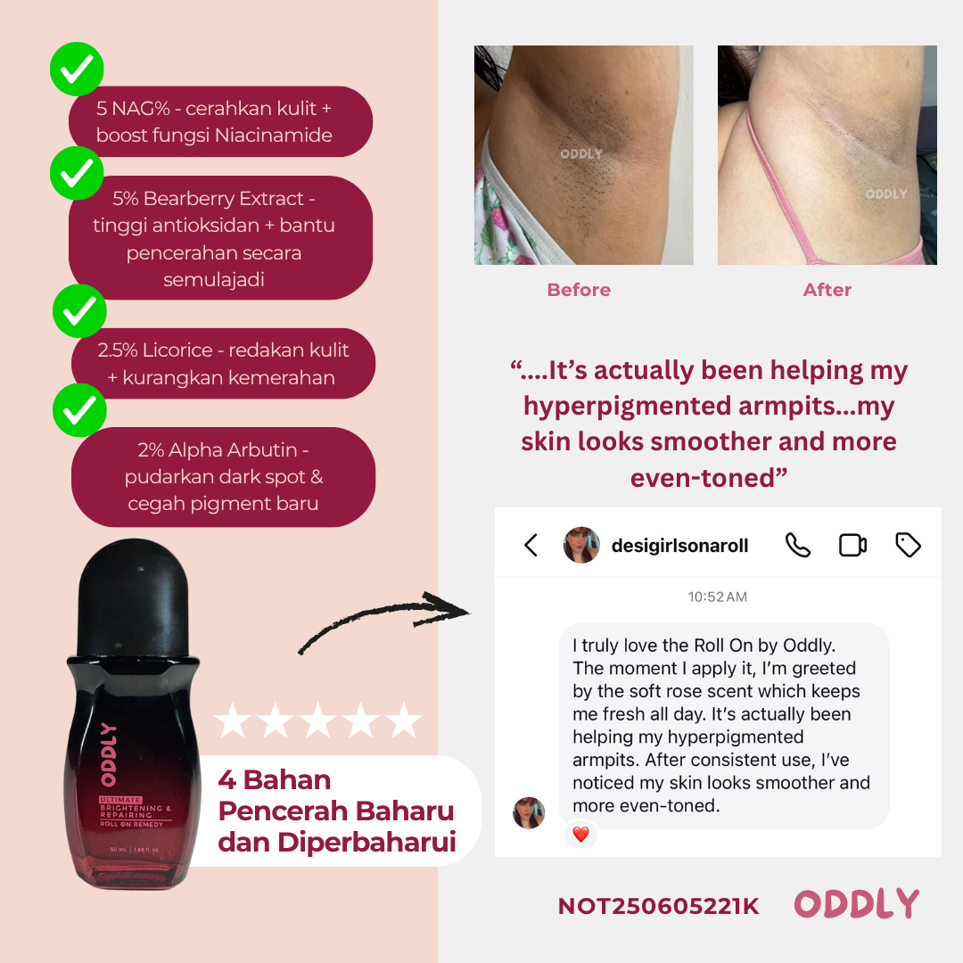 Hiperpigmentasi dah hilang